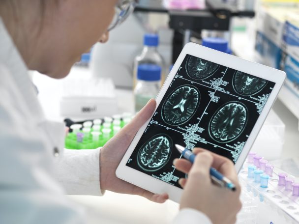 Doctor viewing patient's brain scan on digital tablet in laboratory